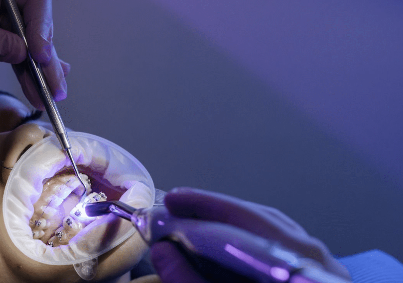 Chequeo Dental Post-Vacacional: Consejos del Centre Dental Francesc Macià para Mantener Tu Salud Oral