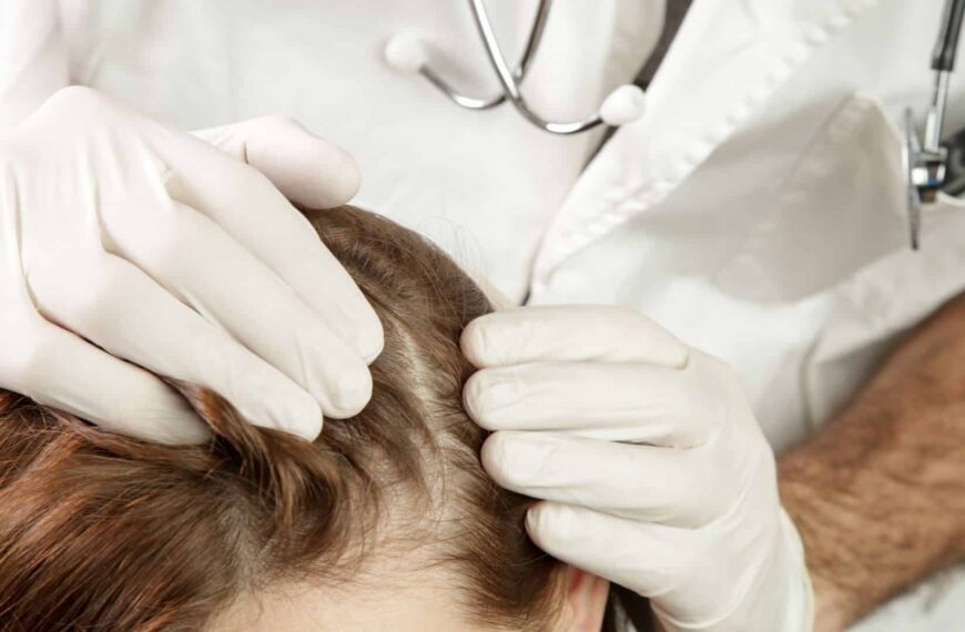 Regulación de la Psoriasis: El Papel Crucial de los Linfocitos T en el Sistema Inmune