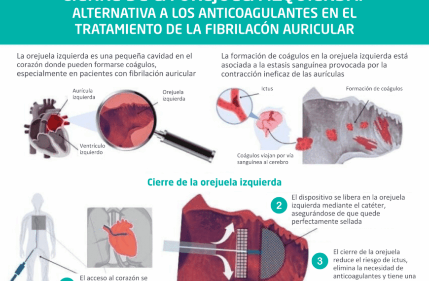 Orejuela: Innovadora Solución para Pacientes con Fibrilación Auricular sin Necesidad de Anticoagulantes