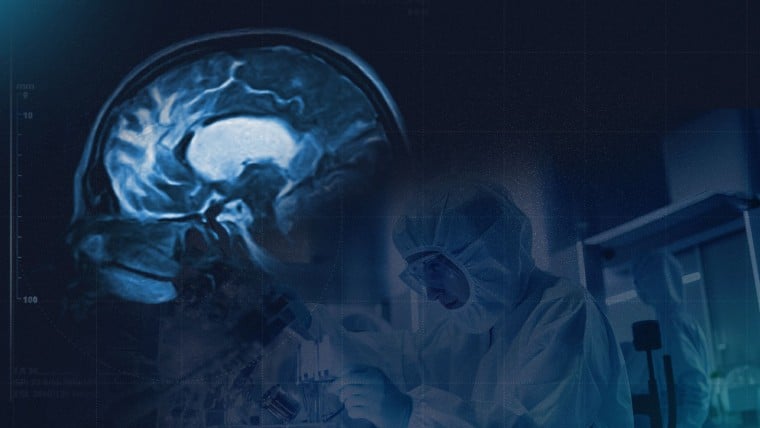 GEN y Sulfateq Revelan Éxito en Fase 1 del Fármaco SUL-238 contra el Alzheimer